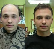 100 % Human Hair Toupee product image